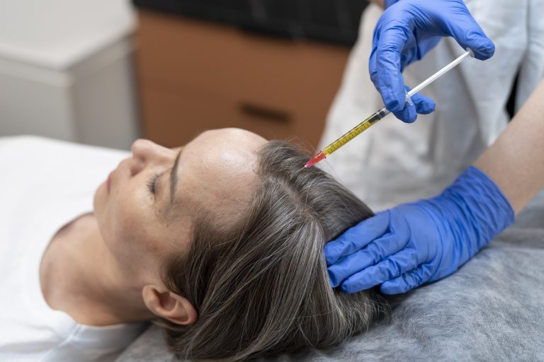 Microneedling With Exosomes Or Stem Cells For Hair Loss