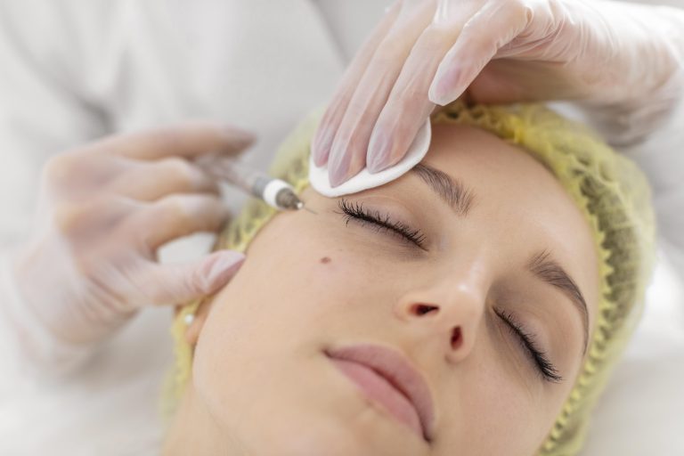 Microneedling with Hyaluronic Acid